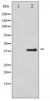 EIF2S1 Antibody - Western blot of eIF2 alpha phosphorylation expression in IFN- alpha treated K562 whole cell lysates,The lane on the left is treated with the antigen-specific peptide.
