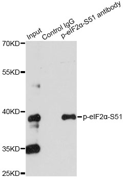 EIF2S1 Antibody - Immunoprecipitation analysis of 200ug extracts of HeLa cells, using 3 ug Phospho-eIF2Î±-S51 pAb. Western blot was performed from the immunoprecipitate using Phospho-eIF2Î±-S51 pAb at a dilition of 1:1000. HeLa cells were treated by Calyculin A (100 nM) at 37°C for 30 minutes after serum-starvation overnight.