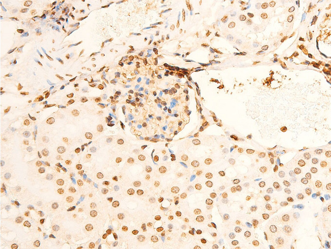 EIF2S1 Antibody - 1:100 staining mouse kidney tissue by IHC-P. The tissue was formaldehyde fixed and a heat mediated antigen retrieval step in citrate buffer was performed. The tissue was then blocked and incubated with the antibody for 1.5 hours at 22°C. An HRP conjugated goat anti-rabbit antibody was used as the secondary.