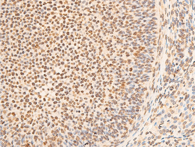 EIF2S1 Antibody - 1:100 staining rat ovarian tissue by IHC-P. The tissue was formaldehyde fixed and a heat mediated antigen retrieval step in citrate buffer was performed. The tissue was then blocked and incubated with the antibody for 1.5 hours at 22°C. An HRP conjugated goat anti-rabbit antibody was used as the secondary.