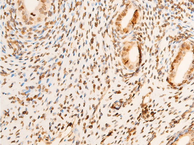 EIF2S1 Antibody - 1:100 staining rat uterine tissue by IHC-P. The tissue was formaldehyde fixed and a heat mediated antigen retrieval step in citrate buffer was performed. The tissue was then blocked and incubated with the antibody for 1.5 hours at 22°C. An HRP conjugated goat anti-rabbit antibody was used as the secondary.