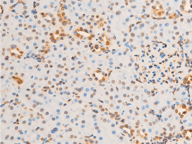 EIF2S1 Antibody - 1:100 staining rat kidney tissue by IHC-P. The tissue was formaldehyde fixed and a heat mediated antigen retrieval step in citrate buffer was performed. The tissue was then blocked and incubated with the antibody for 1.5 hours at 22°C. An HRP conjugated goat anti-rabbit antibody was used as the secondary.
