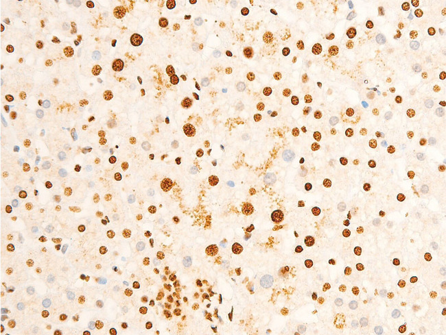 EIF2S1 Antibody - 1:100 staining human lung tissue by IHC-P. The tissue was formaldehyde fixed and a heat mediated antigen retrieval step in citrate buffer was performed. The tissue was then blocked and incubated with the antibody for 1.5 hours at 22°C. An HRP conjugated goat anti-rabbit antibody was used as the secondary.