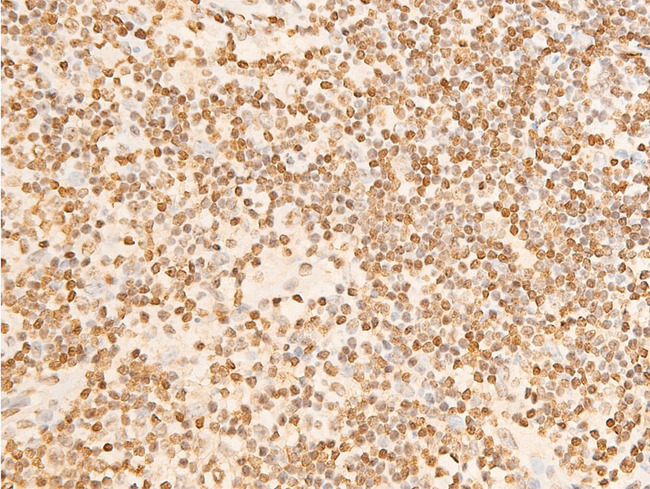 EIF2S1 Antibody - 1:100 staining human appendix tissue by IHC-P. The tissue was formaldehyde fixed and a heat mediated antigen retrieval step in citrate buffer was performed. The tissue was then blocked and incubated with the antibody for 1.5 hours at 22°C. An HRP conjugated goat anti-rabbit antibody was used as the secondary.