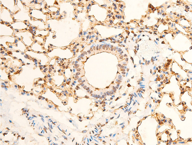 EIF2S1 Antibody - 1:100 staining mouse lung tissue by IHC-P. The tissue was formaldehyde fixed and a heat mediated antigen retrieval step in citrate buffer was performed. The tissue was then blocked and incubated with the antibody for 1.5 hours at 22°C. An HRP conjugated goat anti-rabbit antibody was used as the secondary.