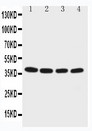 EIF2S2 Antibody - WB of EIF2S2 antibody. Lane 1: M451 Cell Lysate. Lane 2: JURKAT Cell Lysate. Lane 3: HELA Cell Lysate. Lane 4:293T Cell Lysate.