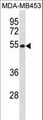 EIF2S2 Antibody - EIF2S2 Antibody western blot of MDA-MB453 cell line lysates (35 ug/lane). The EIF2S2 antibody detected the EIF2S2 protein (arrow).