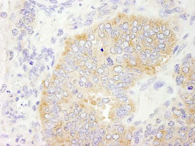 EIF2S2 Antibody - Detection of Mouse eIF2beta/EIF2S2 by Immunohistochemistry. Sample: FFPE section of mouse teratoma. Antibody: Affinity purified rabbit anti-eIF2beta/EIF2S2 used at a dilution of 1:250.