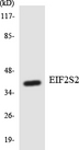 EIF2S2 Antibody - Western blot analysis of the lysates from HT-29 cells using EIF2S2 antibody.