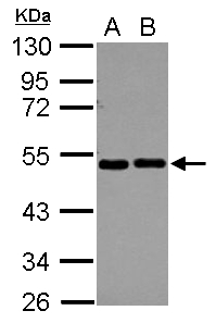 EIF2S2 Antibody - Sample (30 ug of whole cell lysate) A: A549 B: HeLa 10% SDS PAGE EIF2S2 antibody diluted at 1:10000
