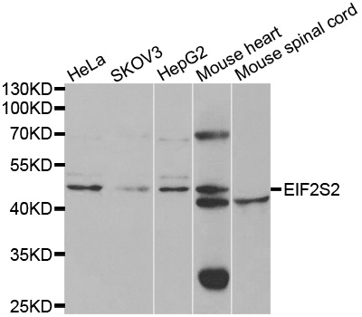 EIF2S2 Antibody - Western blot analysis of extracts of various cell lines.