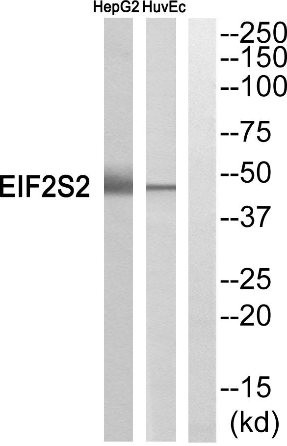 EIF2S2 Antibody - Western blot analysis of extracts from HepG2 cells and HuvEc cells, using EIF2S2 antibody.