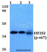 EIF2S2 Antibody - Western blot of p-EIF2S2 (S67) antibody at 1:500 dilution. Lane 1: A549 whole cell lysate. Lane 2: sp2/0 whole cell lysate. Lane 3: PC12 whole cell lysate.