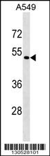 EIF2S3 / EIF2G Antibody - EIF2S3L Antibody (Center) western blot analysis in A549 cell line lysates (35ug/lane).This demonstrates the EIF2S3L antibody detected the EIF2S3L protein (arrow).