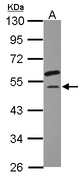EIF2S3 / EIF2G Antibody - Sample (30 ug of whole cell lysate) A: HepG2 10% SDS PAGE EIF2S3 / EIF2G antibody diluted at 1:1000