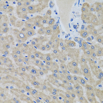 EIF2S3 / EIF2G Antibody - Immunohistochemistry of paraffin-embedded human liver using EIF2S3 antibody at dilution of 1:100 (x40 lens).