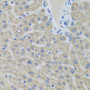 EIF2S3 / EIF2G Antibody - Immunohistochemistry of paraffin-embedded human liver using EIF2S3 antibody at dilution of 1:100 (x40 lens).