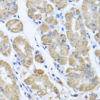 EIF2S3 / EIF2G Antibody - Immunohistochemistry of paraffin-embedded human gastric using EIF2S3 antibody at dilution of 1:100 (x40 lens).