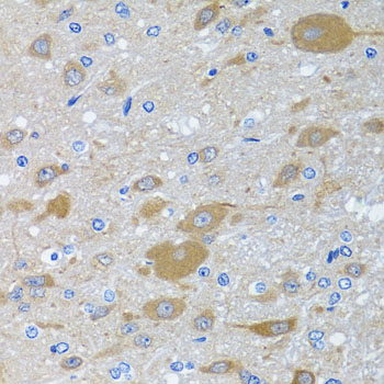 EIF2S3 / EIF2G Antibody - Immunohistochemistry of paraffin-embedded rat brain using EIF2S3 antibody at dilution of 1:100 (x40 lens).