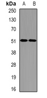 EIF2S3 / EIF2G Antibody - Western blot analysis of eIF2S3 expression in SW620 (A); HL60 (B) whole cell lysates.