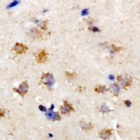 EIF2S3 / EIF2G Antibody - Immunohistochemical analysis of eIF2S3 staining in rat brain formalin fixed paraffin embedded tissue section. The section was pre-treated using heat mediated antigen retrieval with sodium citrate buffer (pH 6.0). The section was then incubated with the antibody at room temperature and detected using an HRP conjugated compact polymer system. DAB was used as the chromogen. The section was then counterstained with hematoxylin and mounted with DPX.