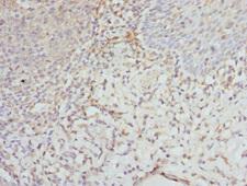EIF2S3 / EIF2G Antibody - Immunohistochemistry of paraffin-embedded human tonsil tissue at dilution 1:100