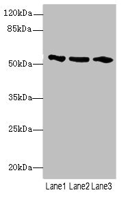 EIF2S3 / EIF2G Antibody - Western blot All Lanes: EIF2S3 antibody at 1.13ug/ml Lane 1 : Hela whole cell lysate Lane 2 : Colo320 whole cell lysate Lane 3 : HL60 whole cell lysate Secondary Goat polyclonal to Rabbit IgG at 1/10000 dilution Predicted band size: 51 kDa Observed band size: 51 kDa