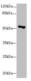 EIF2S3 / EIF2G Antibody - Western blot All lanes: EIF2S3 antibody at 1.13µg/ml + Hela whole cell lysate Secondary Goat polyclonal to rabbit IgG at 1/10000 dilution Predicted band size: 51 kDa Observed band size: 51 kDa