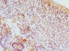 EIF2S3 / EIF2G Antibody - Immunohistochemistry of paraffin-embedded human pancreatic tissue at dilution 1:100