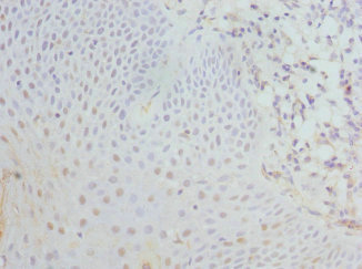 EIF2S3 / EIF2G Antibody - Immunohistochemistry of paraffin-embedded human tonsil tissue at dilution 1:100