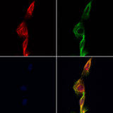 EIF2S3 / EIF2G Antibody - Staining HeLa cells by IF/ICC. The samples were fixed with PFA and permeabilized in 0.1% Triton X-100, then blocked in 10% serum for 45 min at 25°C. Samples were then incubated with primary Ab(1:200) and mouse anti-beta tubulin Ab(1:200) for 1 hour at 37°C. An AlexaFluor594 conjugated goat anti-rabbit IgG(H+L) Ab(1:200 Red) and an AlexaFluor488 conjugated goat anti-mouse IgG(H+L) Ab(1:600 Green) were used as the secondary antibod