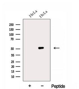 EIF2S3 / EIF2G Antibody