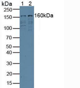 EIF3A Antibody - Western Blot; Sample: Lane1: Human 293T Cells; Lane2: Human Jurkat Cells.