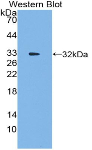 EIF3A Antibody - Western blot of recombinant EIF3A / EIF3.