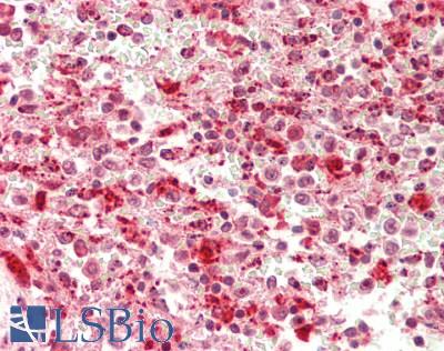 EIF3A Antibody - Human Spleen: Formalin-Fixed, Paraffin-Embedded (FFPE).  This image was taken for the unconjugated form of this product. Other forms have not been tested.