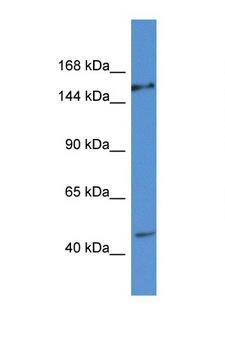 EIF3A Antibody - EIF3A antibody western blot of HeLa Cell lysate. Antibody concentration 1 ug/ml.  This image was taken for the unconjugated form of this product. Other forms have not been tested.