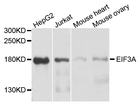 EIF3A Antibody - Western blot analysis of extracts of various cell lines, using EIF3A antibody at 1:1000 dilution. The secondary antibody used was an HRP Goat Anti-Rabbit IgG (H+L) at 1:10000 dilution. Lysates were loaded 25ug per lane and 3% nonfat dry milk in TBST was used for blocking. An ECL Kit was used for detection and the exposure time was 30s.