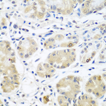 EIF3A Antibody - Immunohistochemistry of paraffin-embedded human stomach using EIF3A antibodyat dilution of 1:100 (40x lens).
