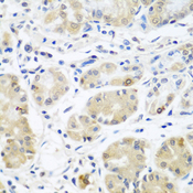 EIF3A Antibody - Immunohistochemistry of paraffin-embedded human stomach using EIF3A antibodyat dilution of 1:100 (40x lens).