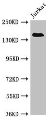 EIF3A Antibody - Western Blot Positive WB detected in:Jurkat whole cell lysate All Lanes:EIF3A antibody at 4µg/ml Secondary Goat polyclonal to rabbit IgG at 1/50000 dilution Predicted band size: 167,163 KDa Observed band size: 167 KDa