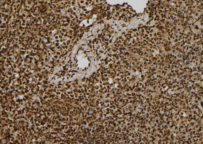 EIF3A Antibody - 1:100 staining mouse spleen tissue by IHC-P. The sample was formaldehyde fixed and a heat mediated antigen retrieval step in citrate buffer was performed. The sample was then blocked and incubated with the antibody for 1.5 hours at 22°C. An HRP conjugated goat anti-rabbit antibody was used as the secondary.