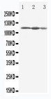 EIF3B Antibody - WB of EIF3B antibody. Lane 1: HELA Cell Lysate. Lane 2: 293T Cell Lysate. Lane 3: A431 Cell Lysate..
