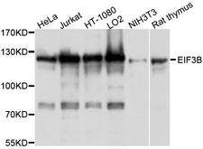 EIF3B Antibody - Western blot analysis of extracts of various cell lines, using EIF3B antibody at 1:1000 dilution. The secondary antibody used was an HRP Goat Anti-Rabbit IgG (H+L) at 1:10000 dilution. Lysates were loaded 25ug per lane and 3% nonfat dry milk in TBST was used for blocking. An ECL Kit was used for detection and the exposure time was 1s.