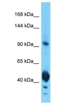 EIF3C / EIF3S8 Antibody - EIF3C / EIF3S8 antibody Western Blot of ACHN. Antibody dilution: 1 ug/ml.  This image was taken for the unconjugated form of this product. Other forms have not been tested.