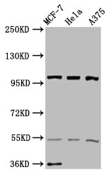 EIF3C / EIF3S8 Antibody - Western Blot Positive WB detected in: MCF-7 whole cell lysate, Hela whole cell lysate, A375 whole cell lysate All lanes: EIF3C antibody at 3.4µg/ml Secondary Goat polyclonal to rabbit IgG at 1/50000 dilution Predicted band size: 106, 105 kDa Observed band size: 106 kDa