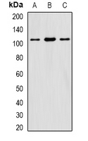EIF3C / EIF3S8 Antibody - Western blot analysis of eIF3C expression in HepG2 (A); SW620 (B); mouse testis (C) whole cell lysates.