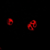 EIF3C / EIF3S8 Antibody - Immunofluorescent analysis of eIF3C staining in U2OS cells. Formalin-fixed cells were permeabilized with 0.1% Triton X-100 in TBS for 5-10 minutes and blocked with 3% BSA-PBS for 30 minutes at room temperature. Cells were probed with the primary antibody in 3% BSA-PBS and incubated overnight at 4 deg C in a humidified chamber. Cells were washed with PBST and incubated with a DyLight 594-conjugated secondary antibody (red) in PBS at room temperature in the dark.