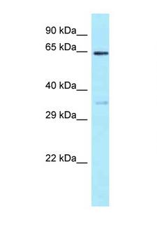 EIF3D Antibody - EIF3D antibody Western blot of HT1080 Cell lysate. Antibody concentration 1 ug/ml.  This image was taken for the unconjugated form of this product. Other forms have not been tested.