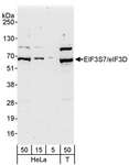 EIF3D Antibody - Detection of Human eIF3D/EIF3S7 by Western Blot. Samples: Whole cell lysate from HeLa (5, 15 and 50 ug for WB) and 293T (T; 50 ug) cells. Antibodies: Affinity purified rabbit anti-eIF3D/EIF3S7 antibody used for WB at 0.04 ug/ml. Detection: Chemiluminescence with an exposure time of 3 minutes.