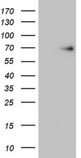 EIF3D Antibody - HEK293T cells were transfected with the pCMV6-ENTRY control. (Left lane) or pCMV6-ENTRY EIF3D. (Right lane) cDNA for 48 hrs and lysed. Equivalent amounts of cell lysates. (5 ug per lane) were separated by SDS-PAGE and immunoblotted with anti-EIF3D. (1:2000)